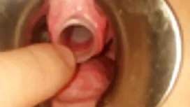 Velocity Von interracial anal ejaculação interna